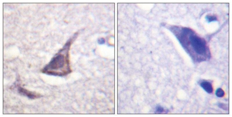 Merck Anti-Calcium Sensing Receptor antibody produced in rabbit