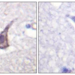 Merck Anti-Calcium Sensing Receptor antibody produced in rabbit