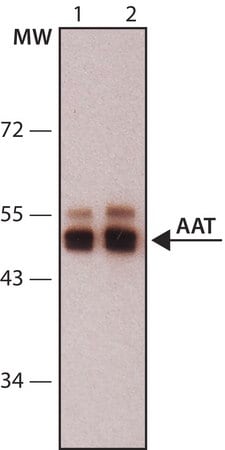 Merck Anti-Alpha-1-Antitrypsin (AAT) antibody,Mouse monoclonal