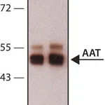 Merck Anti-Alpha-1-Antitrypsin (AAT) antibody,Mouse monoclonal