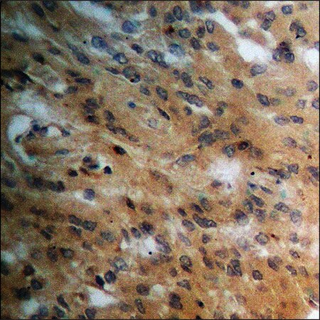 Merck Anti-phospho-PPAR-gamma (pSer112) antibody produced in rabbit