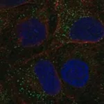 Merck Anti-TDGF1 antibody produced in rabbit