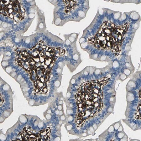 Merck Anti-GRAMD1C antibody produced in rabbit