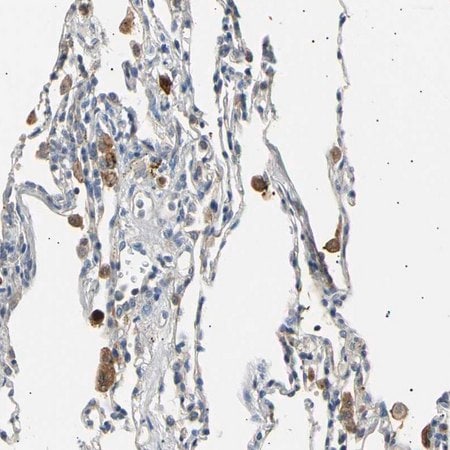 Merck Anti-LDLR antibody produced in rabbit