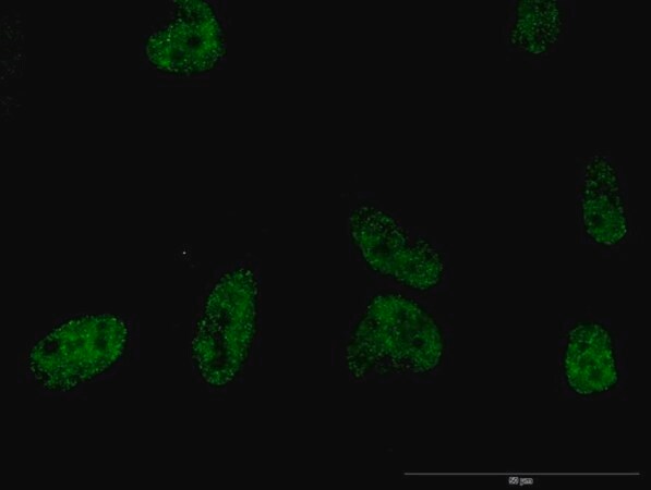 Merck Monoclonal Anti-PLCB2 antibody produced in mouse