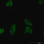 Merck Monoclonal Anti-PLCB2 antibody produced in mouse