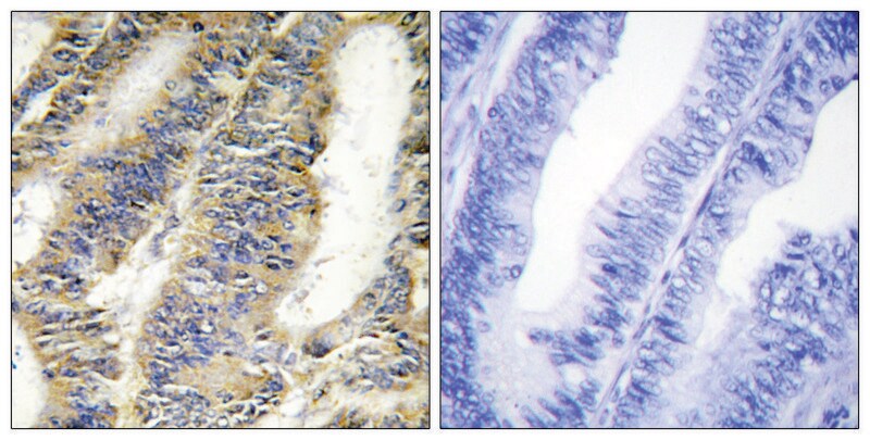 Merck Anti-TNFA antibody produced in rabbit