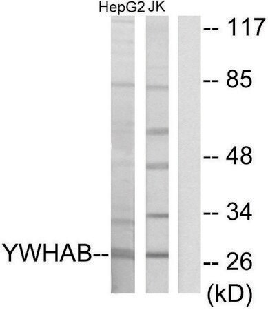 Merck Anti-14-3-3 beta antibody produced in rabbit