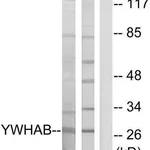 Merck Anti-14-3-3 beta antibody produced in rabbit