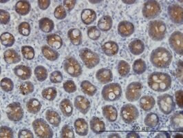 Merck MONOCLONAL ANTI-KRT4