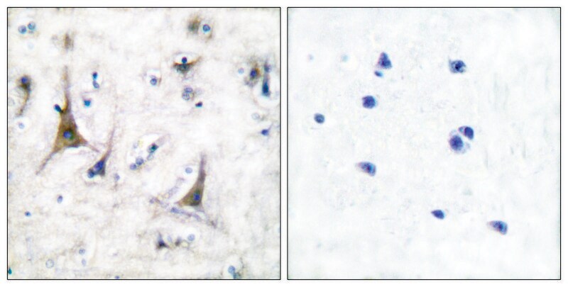 Merck Anti-PGP9.5 antibody produced in rabbit