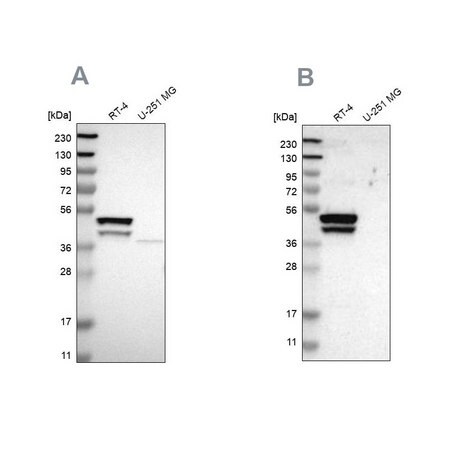 Merck Anti-KRT23 antibody produced in rabbit