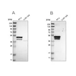 Merck Anti-KRT23 antibody produced in rabbit