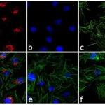Thermo Fisher Scientific Goat anti-Rabbit IgG (H+L) Cross-Adsorbed Secondary Antibody, Texas Red