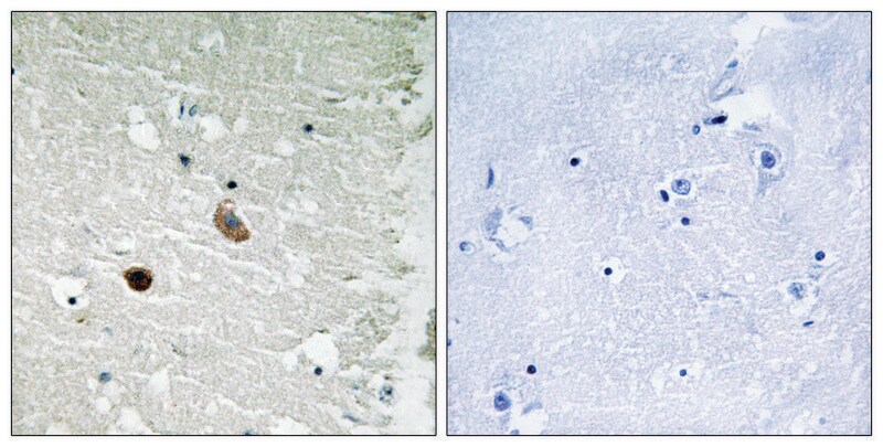 Merck Anti-CAMK2 antibody produced in rabbit