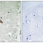 Merck Anti-CAMK2 antibody produced in rabbit