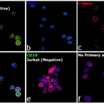 Thermo Fisher Scientific Mouse anti-Rat Kappa Light Chain Secondary Antibody, FITC