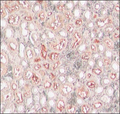 Merck Anti-ACE2 (C-terminal) antibody produced in rabbit