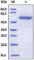 Merck CARBONIC ANHYDRASE 9/CA9,HUMAN