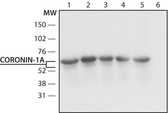 Merck Anti-Coronin-1A (N-terminal) antibody produced in rabbit