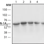 Merck Anti-Coronin-1A (N-terminal) antibody produced in rabbit