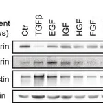 Merck ANTI-FIBRONECTIN DEVELOPED IN RABBIT &