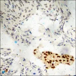 Merck Anti-phospho-Estrogen Receptor-alpha (pSer118) antibody produced in rabbit