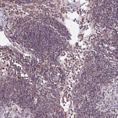 Merck Anti-CSF3R antibody produced in rabbit