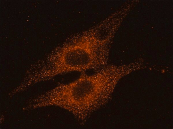 Merck Anti-Rab14 antibody produced in rabbit