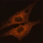 Merck Anti-Rab14 antibody produced in rabbit