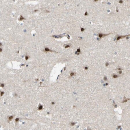 Merck Anti-KDM7A antibody produced in rabbit