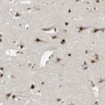 Merck Anti-KDM7A antibody produced in rabbit