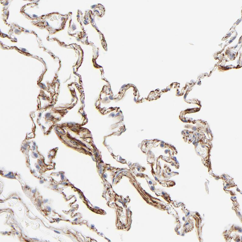 Atlas Antibodies Anti-LTBP2 Antibody