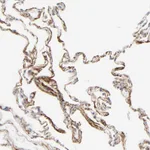 Atlas Antibodies Anti-LTBP2 Antibody