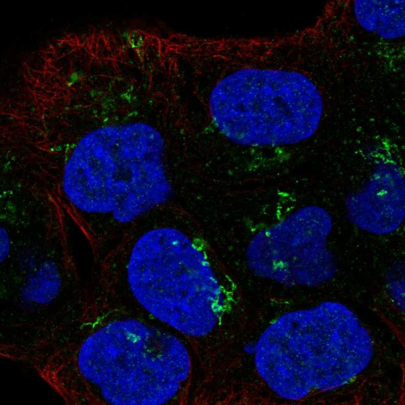 Atlas Antibodies Anti-LTBR Antibody