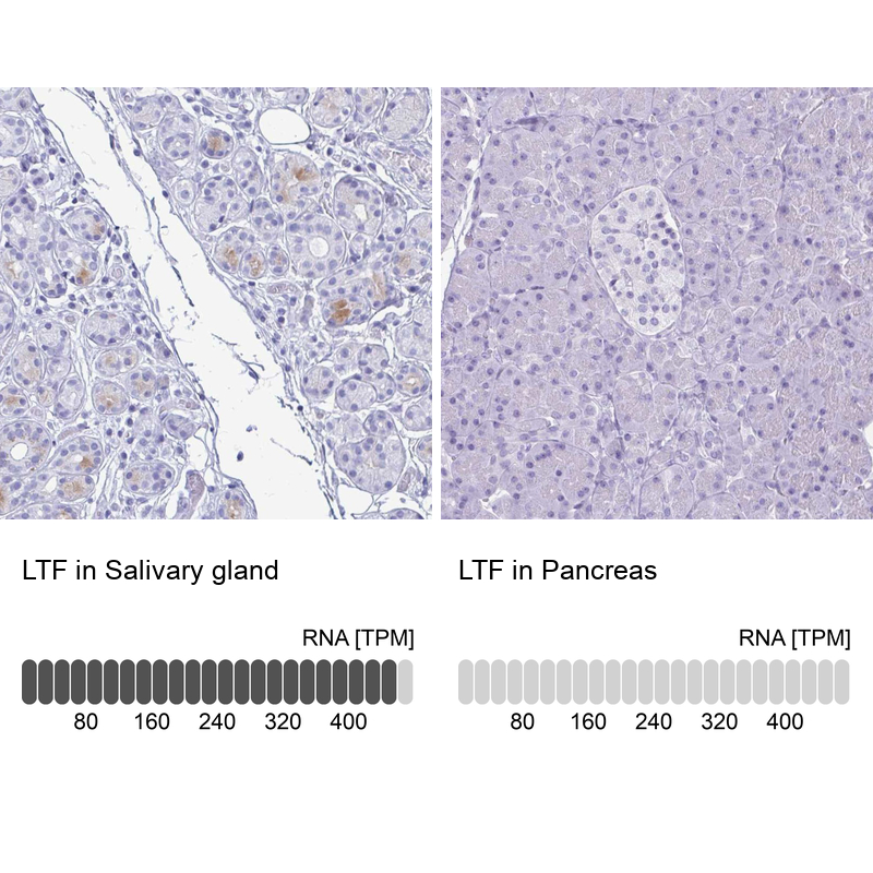 Atlas Antibodies Anti-LTF Antibody
