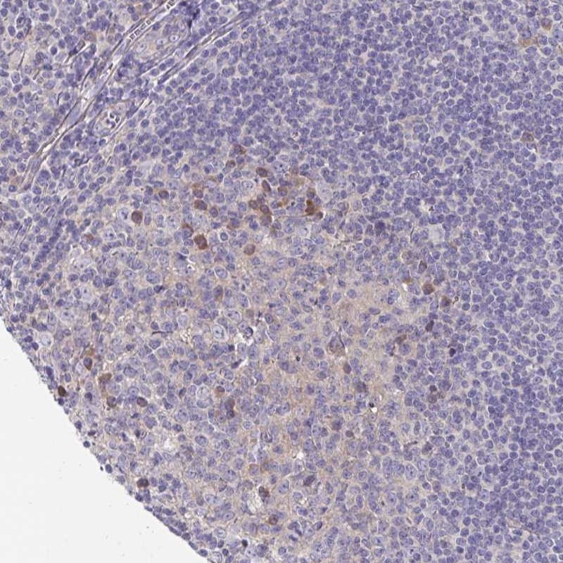Atlas Antibodies Anti-LTK Antibody