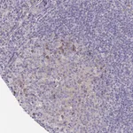 Atlas Antibodies Anti-LTK Antibody