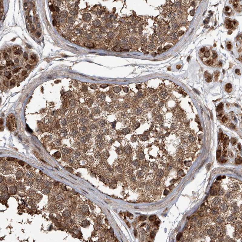Atlas Antibodies Anti-LTV1 Antibody