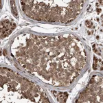 Atlas Antibodies Anti-LTV1 Antibody