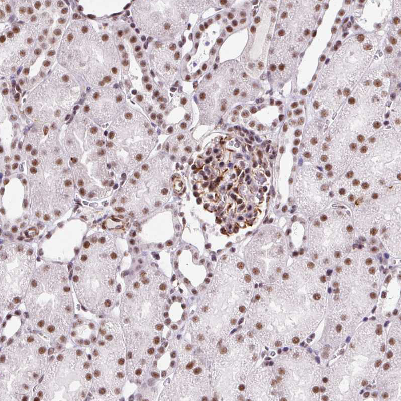 Atlas Antibodies Anti-LUC7L2 Antibody