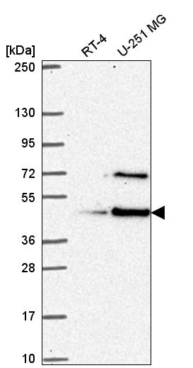 Atlas Antibodies Anti-LUC7L Antibody