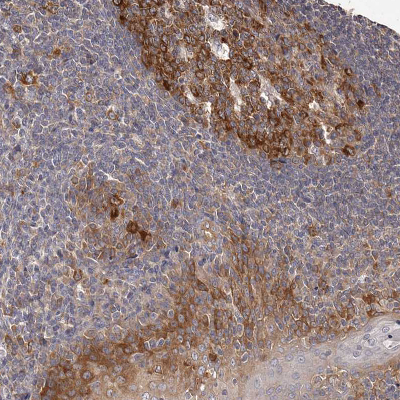 Atlas Antibodies Anti-LTV1 Antibody
