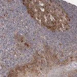 Atlas Antibodies Anti-LTV1 Antibody