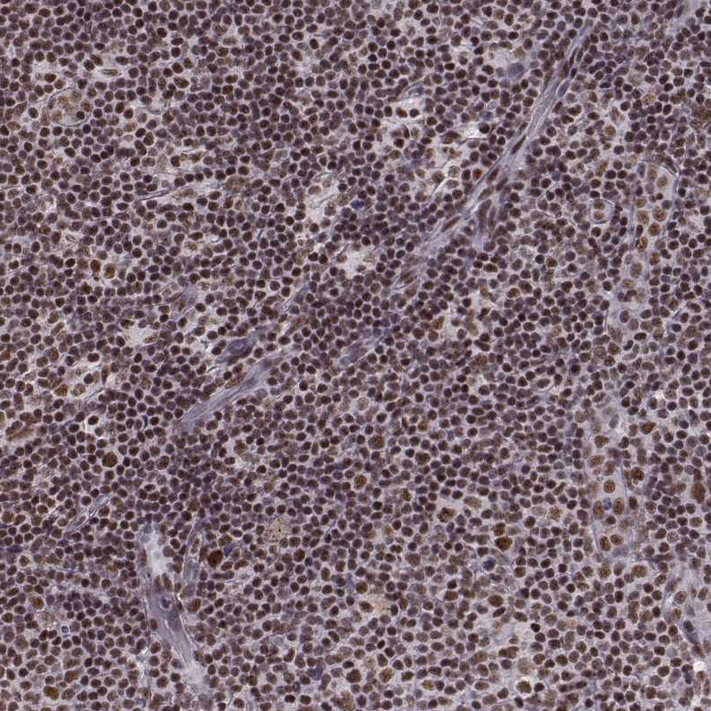 Atlas Antibodies Anti-LUC7L Antibody