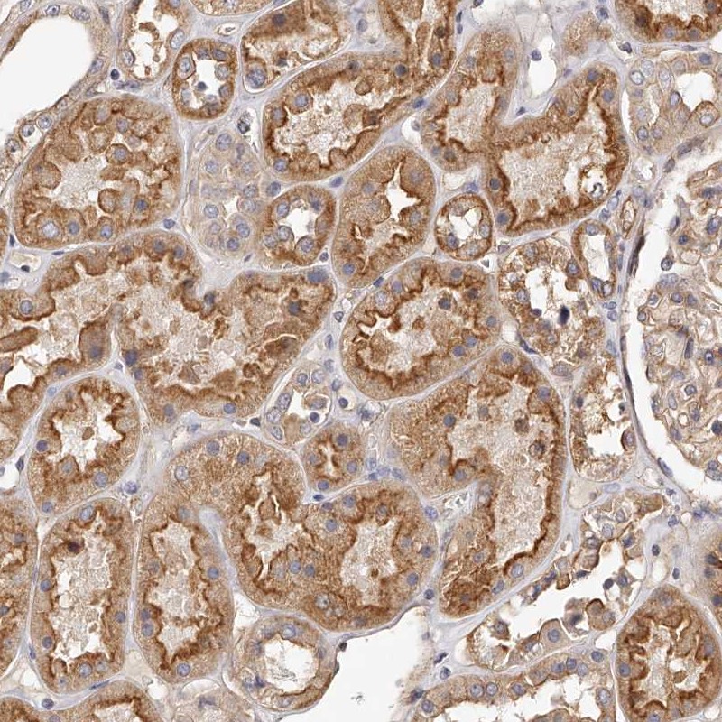 Atlas Antibodies Anti-LTV1 Antibody