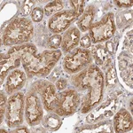 Atlas Antibodies Anti-LTV1 Antibody