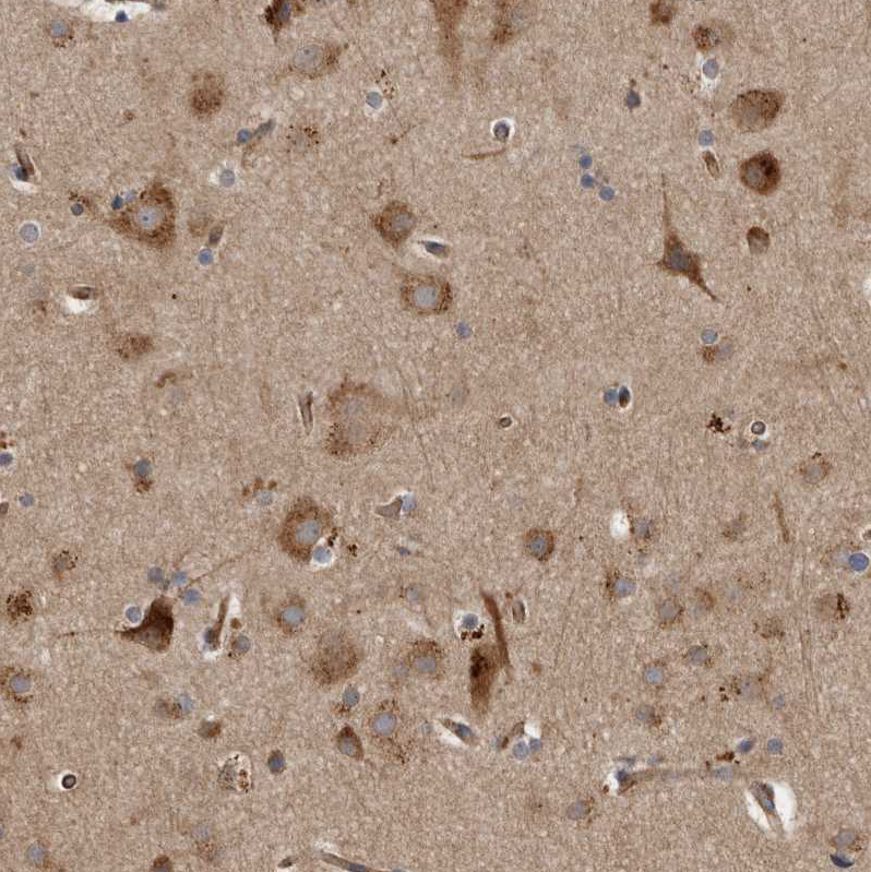 Atlas Antibodies Anti-LUZP1 Antibody