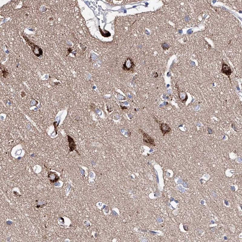 Atlas Antibodies Anti-LURAP1 Antibody