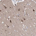 Atlas Antibodies Anti-LURAP1 Antibody